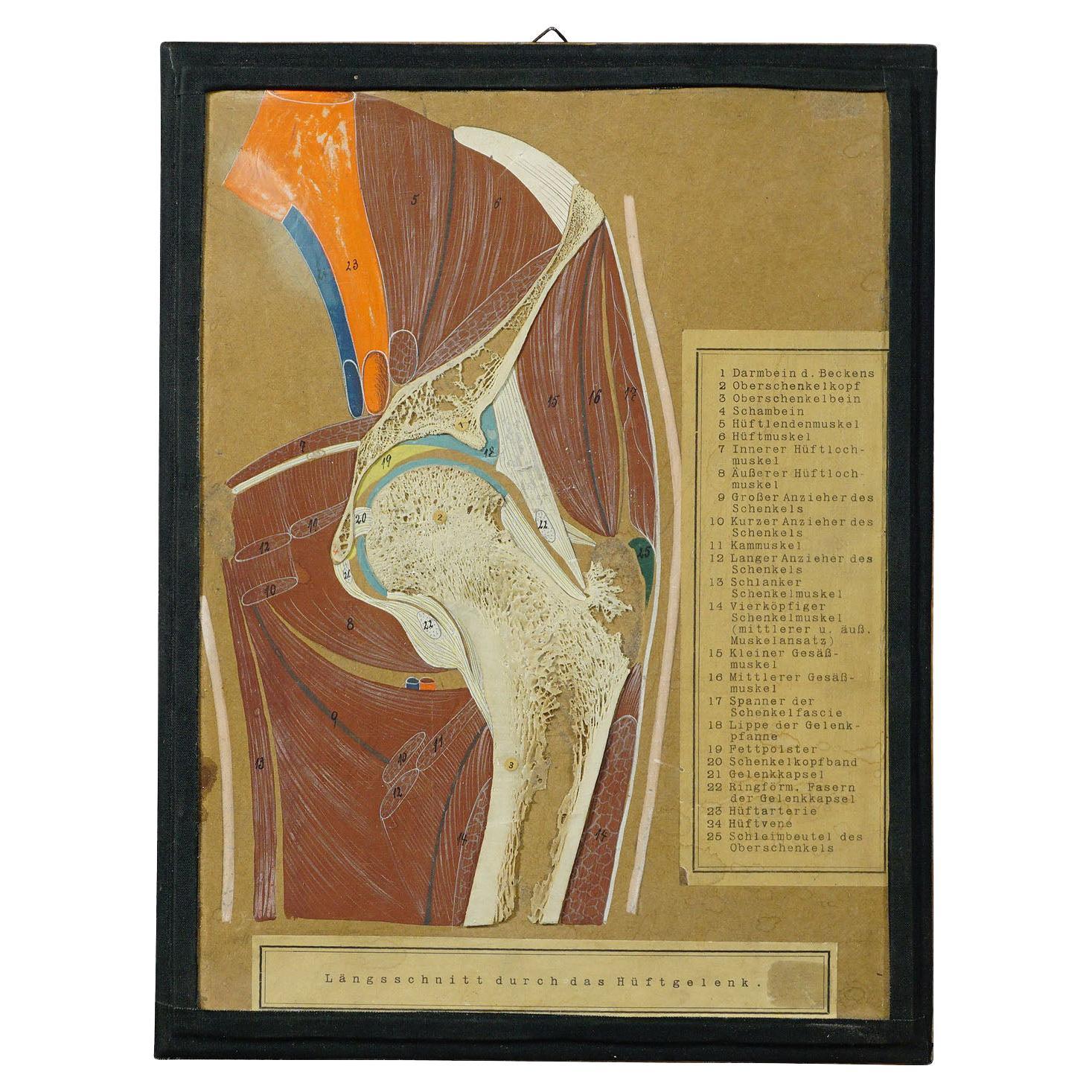 Antique Scientific Demonstration Model, Bone Cut of the Hip Joint