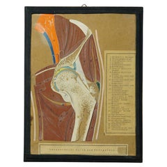 Antique Scientific Demonstration Model, Bone Cut of the Hip Joint
