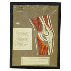 Antique Scientific Visual Aid, Bone Cut of the Human Elbow