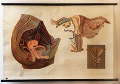 École suédoise ancienne, tableau d'enseignement, affiche « Organs féminins pelviens »