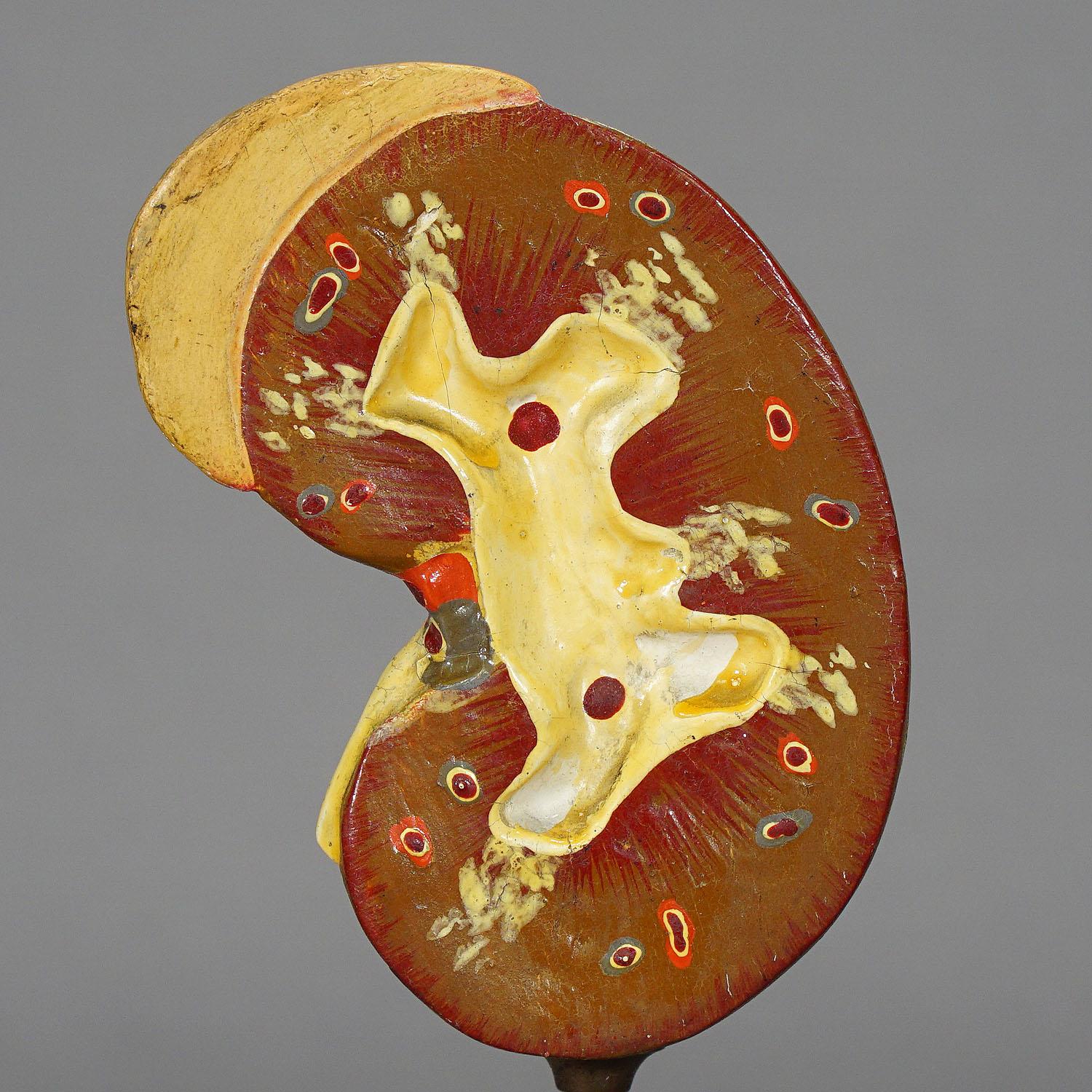 A great antique hand-painted anatomical model of the kidney. Made of papier maché and plaster, mounted on a turned wooden base. Manufactured most probably by SOMSO or PHYWE, Germany ca. 1900. Very good condition.

Measures: Height: 8.27