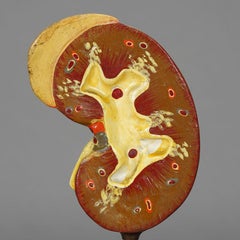 Modelo antiguo de enseñanza Perfil longitudinal del riñón, ca. 1900