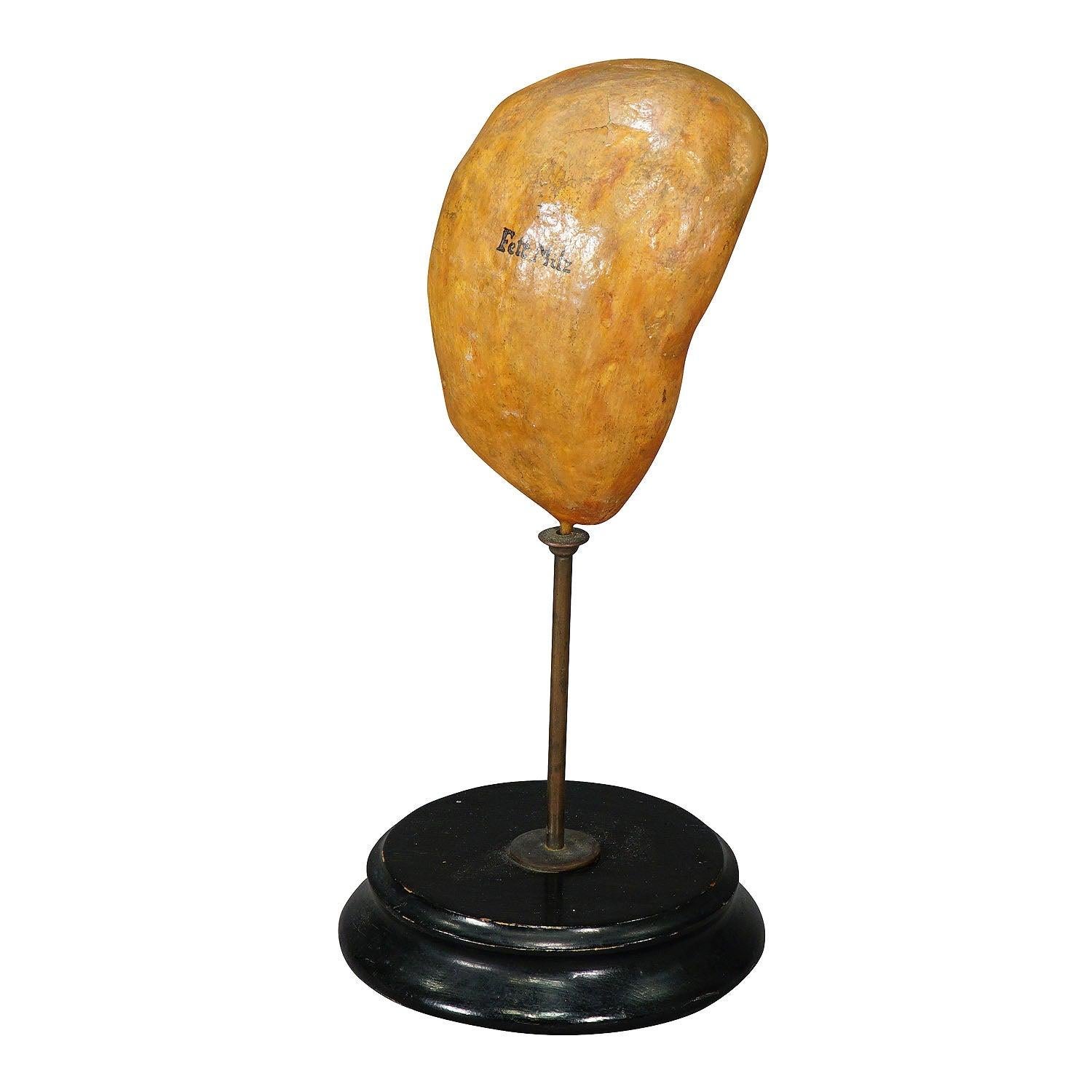 Modelo antiguo de enseñanza del bazo adiposo, ca. 1900