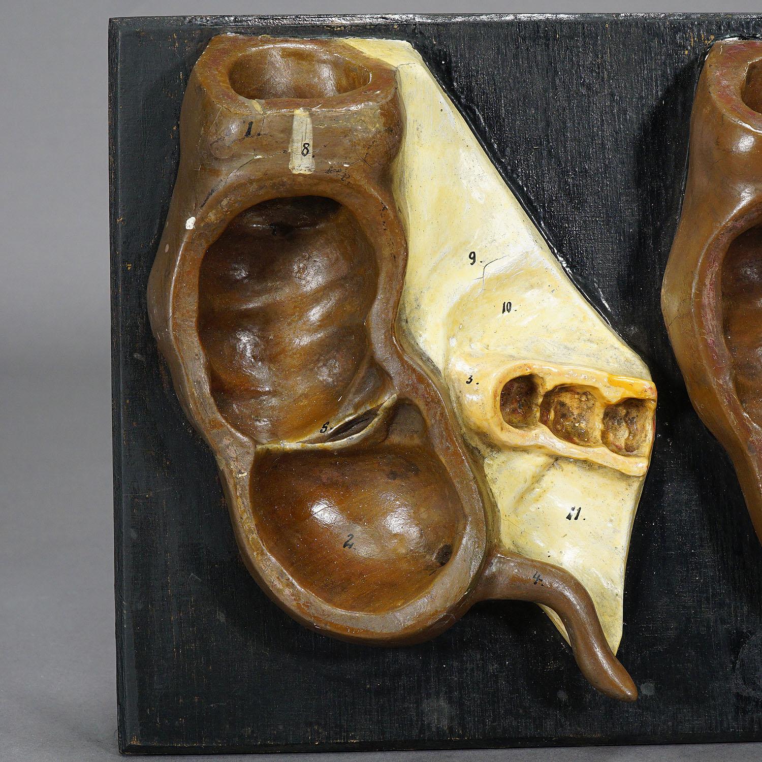 A great antique hand-painted anatomical model of the appendix in different stages. It is made of plaster and mounted on a wooden base. Manufactured most probably by SOMSO or PHYWE, Germany ca. 1900. Very good condition. 

Measures: Width: 18.31