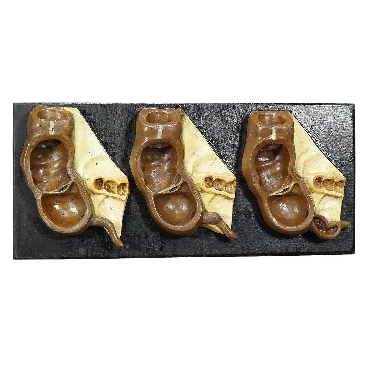 Antique Teaching Model Stages of the Appendix, Ca. 1900 For Sale at ...