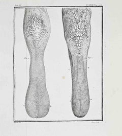 Comparative Anatomical Study–Pathological... - Etching by Antoine Defehrt - 1771