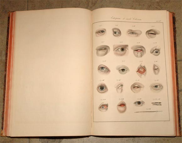 One of the rarest and most beautiful atlases of ophtalmology, and probably the best summary of the knowledge of diseases of the eye prior to the introduction of the ophtamoscope. Contains nearly 1000 figures, mostly hand colored and life size.