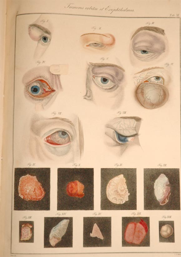 German Extremely rare Ophthalmology book