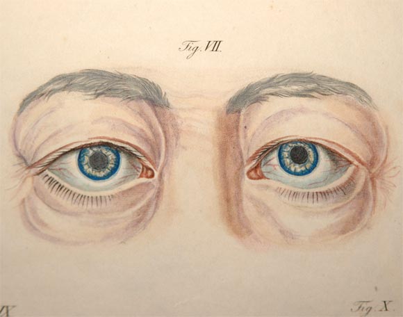 19th Century Extremely rare Ophthalmology book