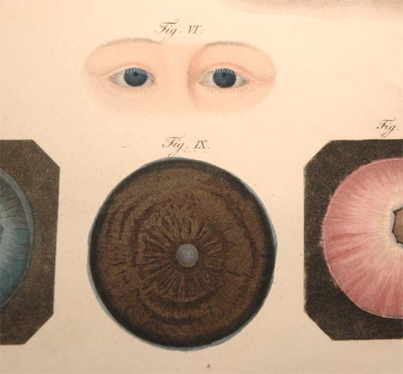 Extremely rare Ophthalmology book 1