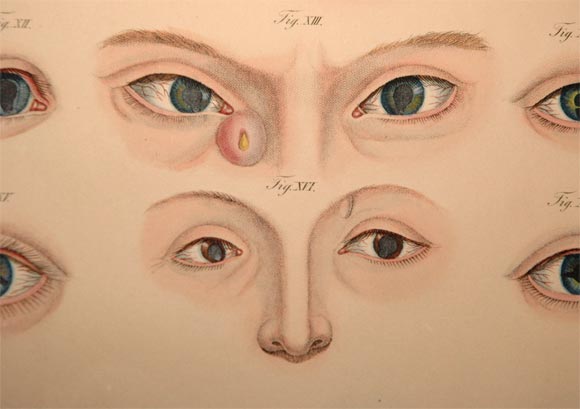 Extremely rare Ophthalmology book 2
