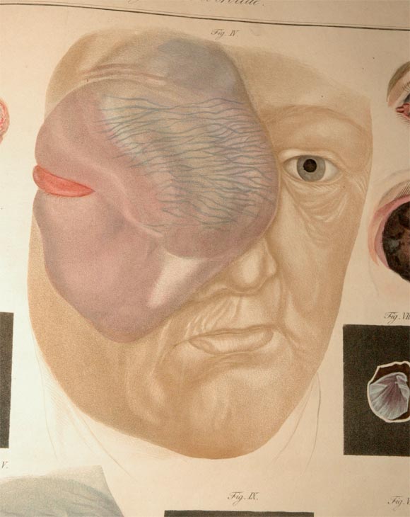 Extremely rare Ophthalmology book 4