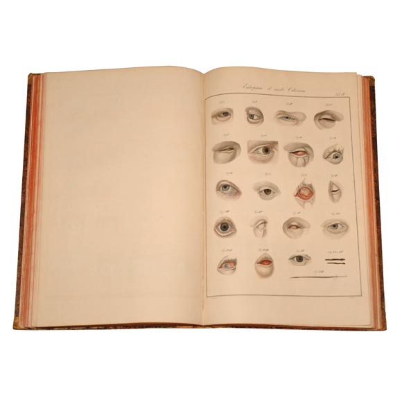 Extremely rare Ophthalmology book