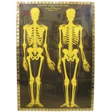 Large Black Background Skelton Chart