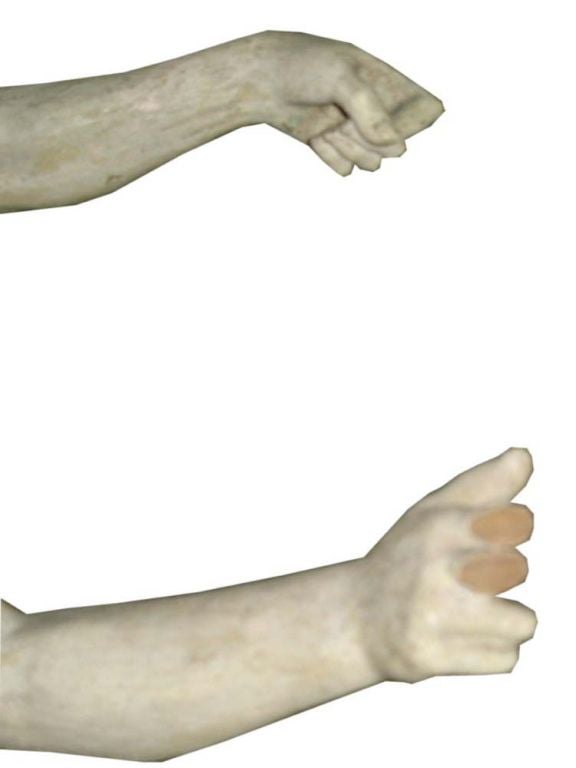 Santos Figure 2