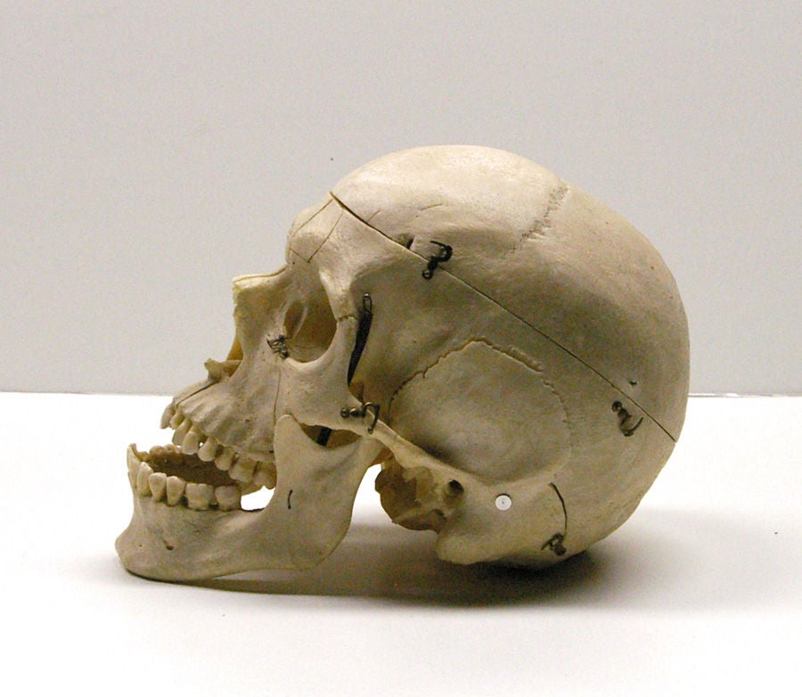 Belgian Human Skull in Custom-Fitted Wooden Box