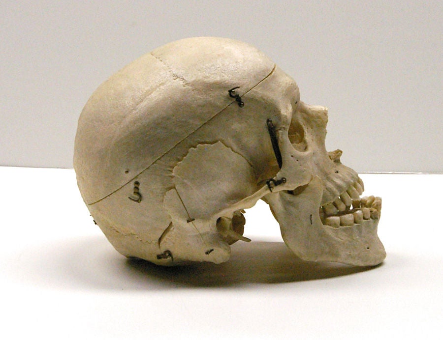 20th Century Human Skull in Custom-Fitted Wooden Box