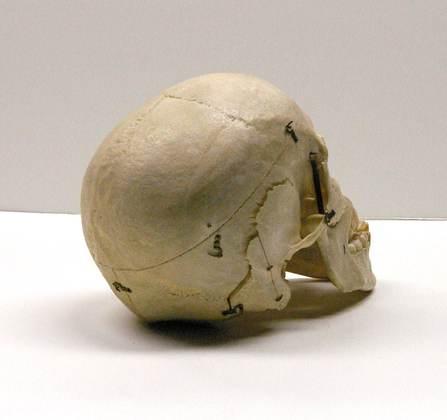Human Skull in Custom-Fitted Wooden Box 3