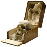 Vintage Human Skull in Custom-Fitted Wooden Box