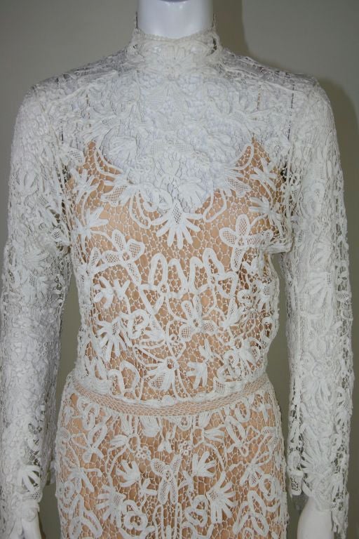 irish lace wedding dress