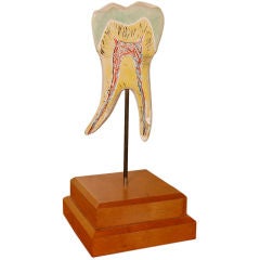 1950's Giant Plaster Tooth Model
