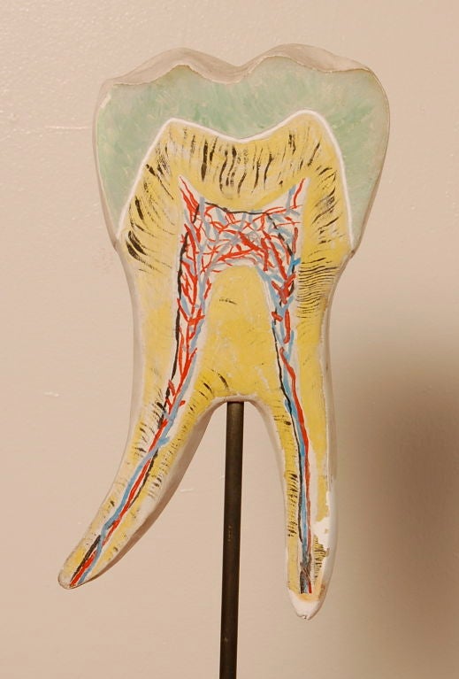 1950's vintage hand painted plaster cast model of a tooth (molar) mounted on a solid wood base.