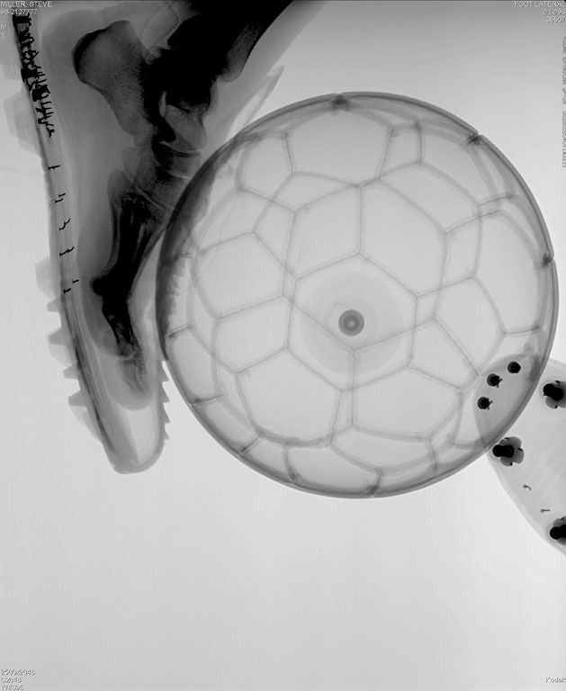 Steve Miller Black and White Photograph - "Foot and Ball", 1999