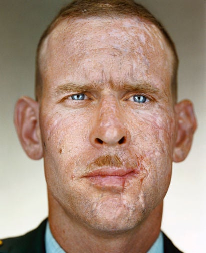 Joseph Mosner, 2004 - Photograph de Martin Schoeller