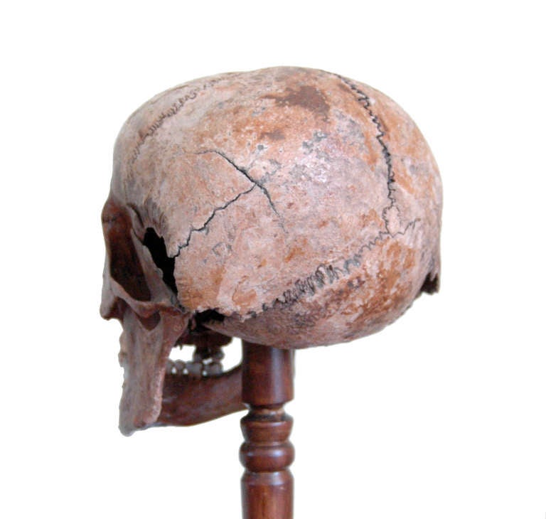 Very Early Example of a Diseased Human Skull In Fair Condition In Glamis, Angus