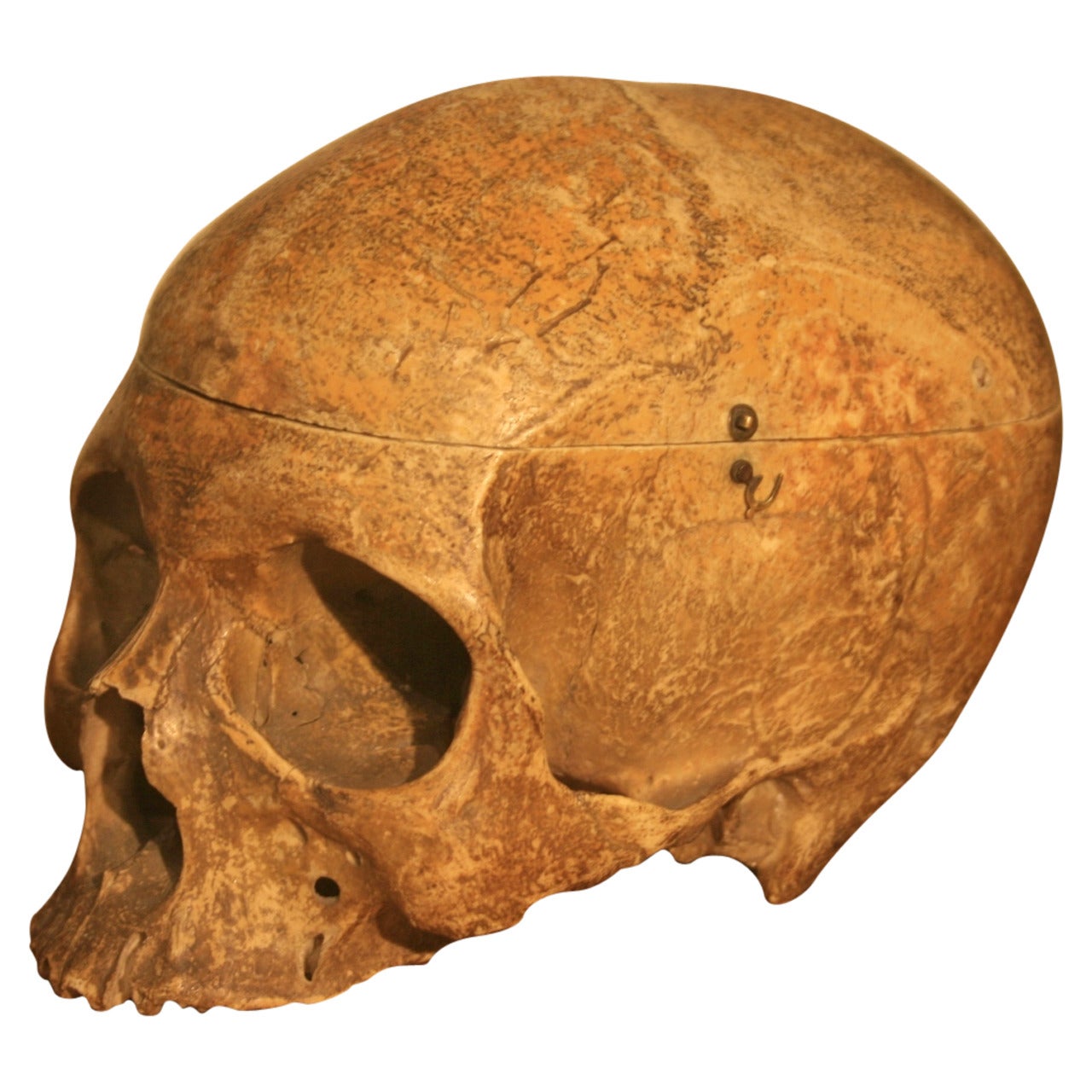 19th Century Medical School Human Skull