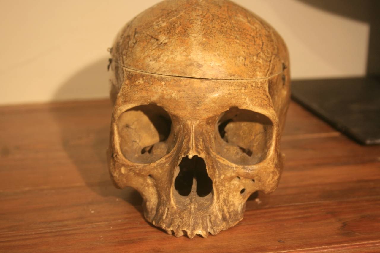 American 19th Century Medical School Human Skull