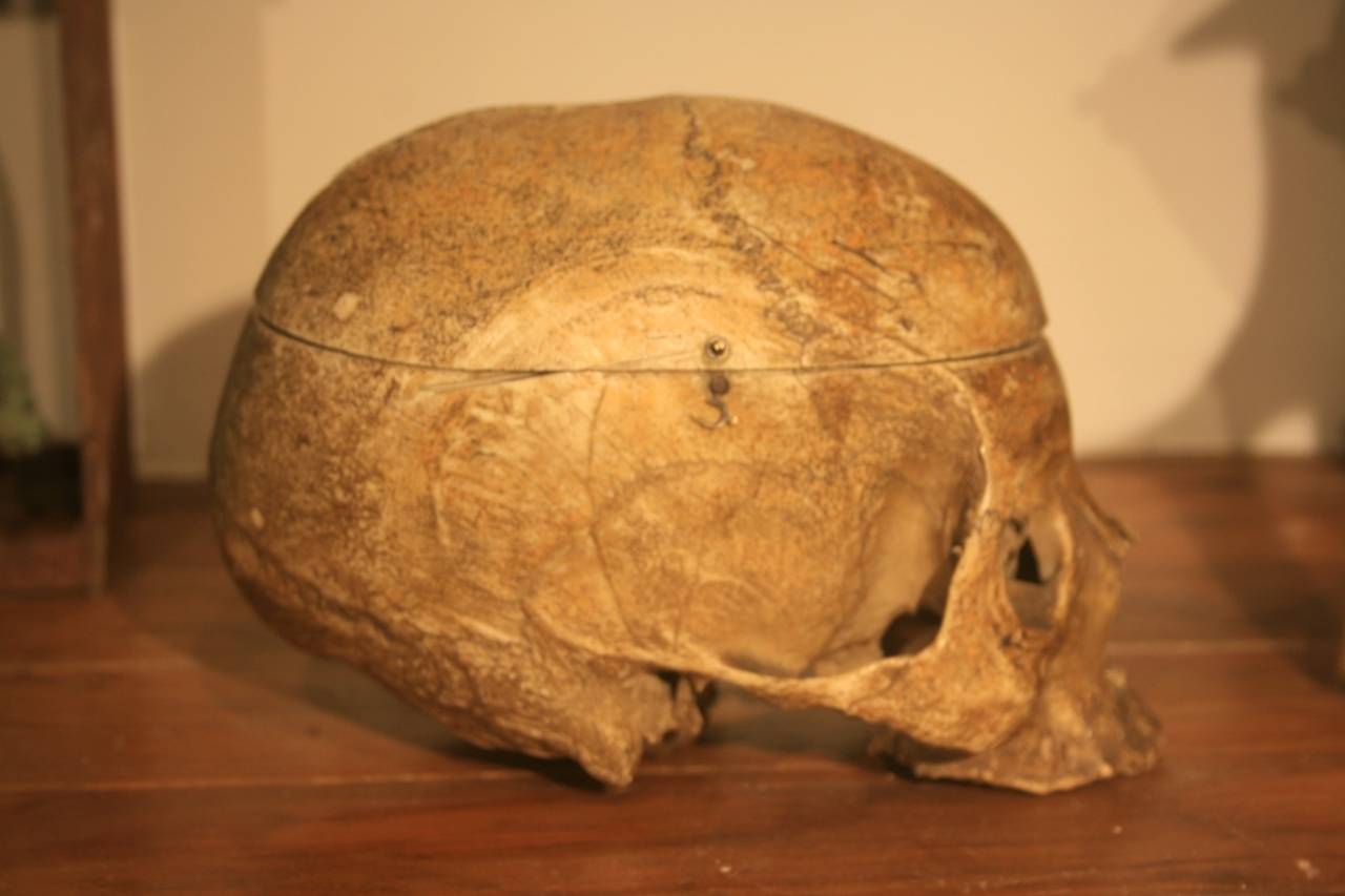 19th Century Medical School Human Skull 4