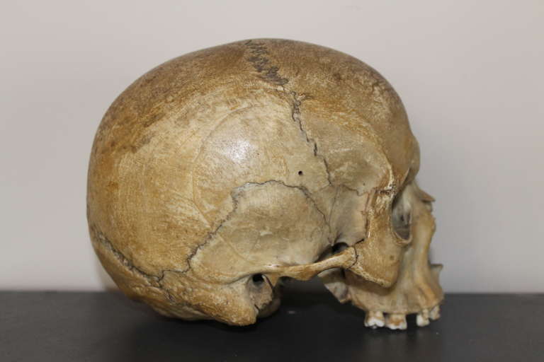 Human Medical Skull, 19th Century