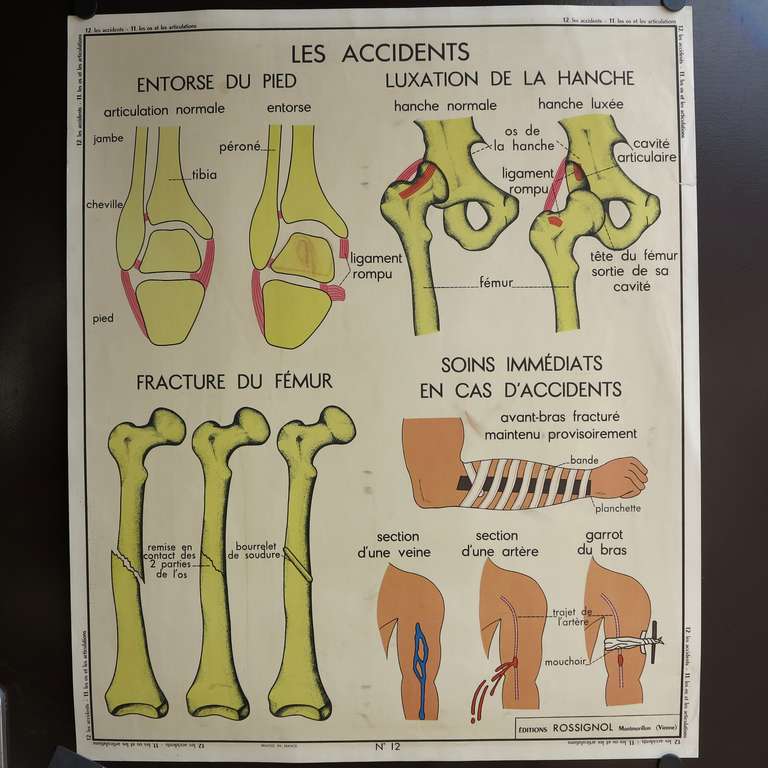 Vintage human anatomy school chart, France, circa 1950 - 1955.

Title: Les Accidents / Les Os Et Articulations.

Material: Carton, printed on both sides.

Year: 1950 - 1955.

Measure : 89 x 75 cm.

Manufacturer: Edition