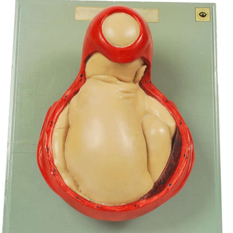 Anatomic model in plaster and papier mache depicting the baby at birth. Model from the Hygiene Museum in Dresden, 1940s. Very good condition. Table measures 45x35 cm - inches 17.71x13.77.
Shipping in insured by Lloyd's London and the gift box is