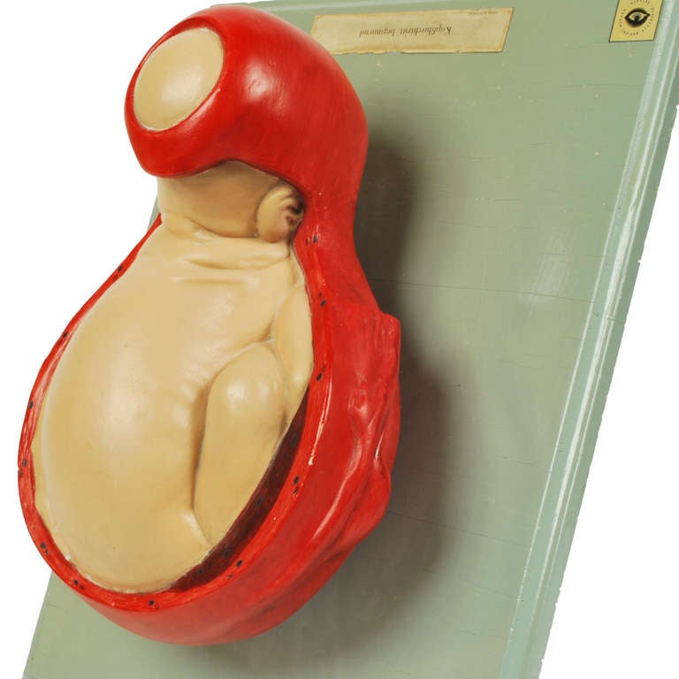 German Anatomic Model of Baby Birthing 1940s In Excellent Condition In Milan, IT