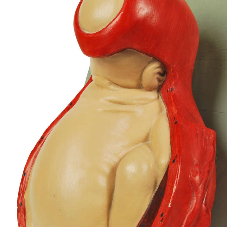 Mid-20th Century German Anatomic Model of Baby Birthing 1940s