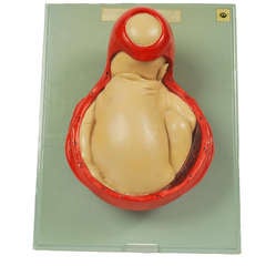 German Anatomic Model of Baby Birthing 1940s 6