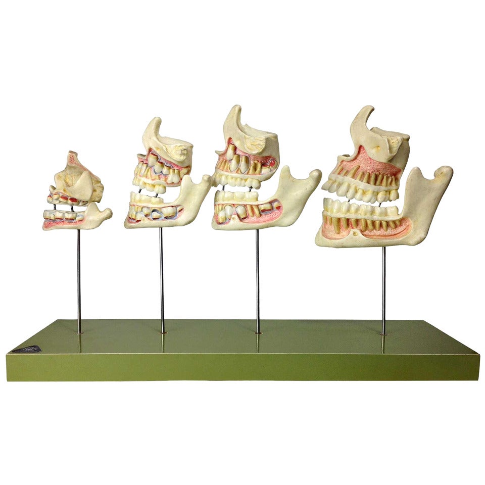 Dental Model from Western Germany