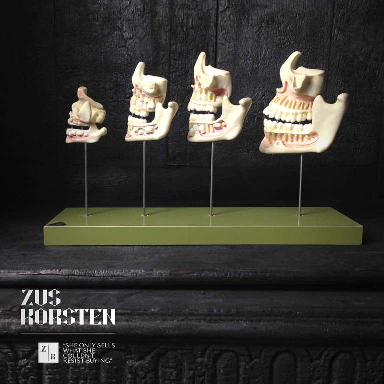 Educational model showing different stages from primary teeth to an adult set. The model is made of some sort of resin and hand colored.