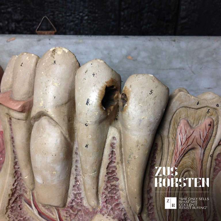Mid-20th Century Anatomical Dental Model by Somso