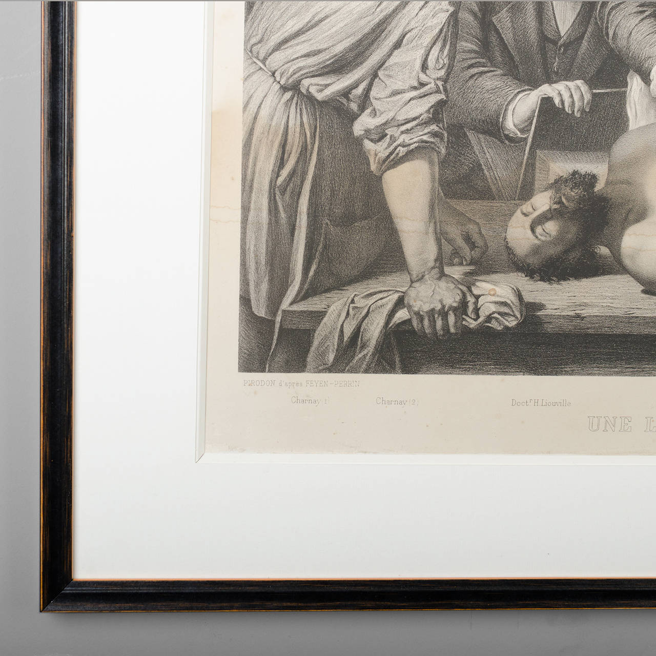 Two 19th Century Medical Lithographies 3