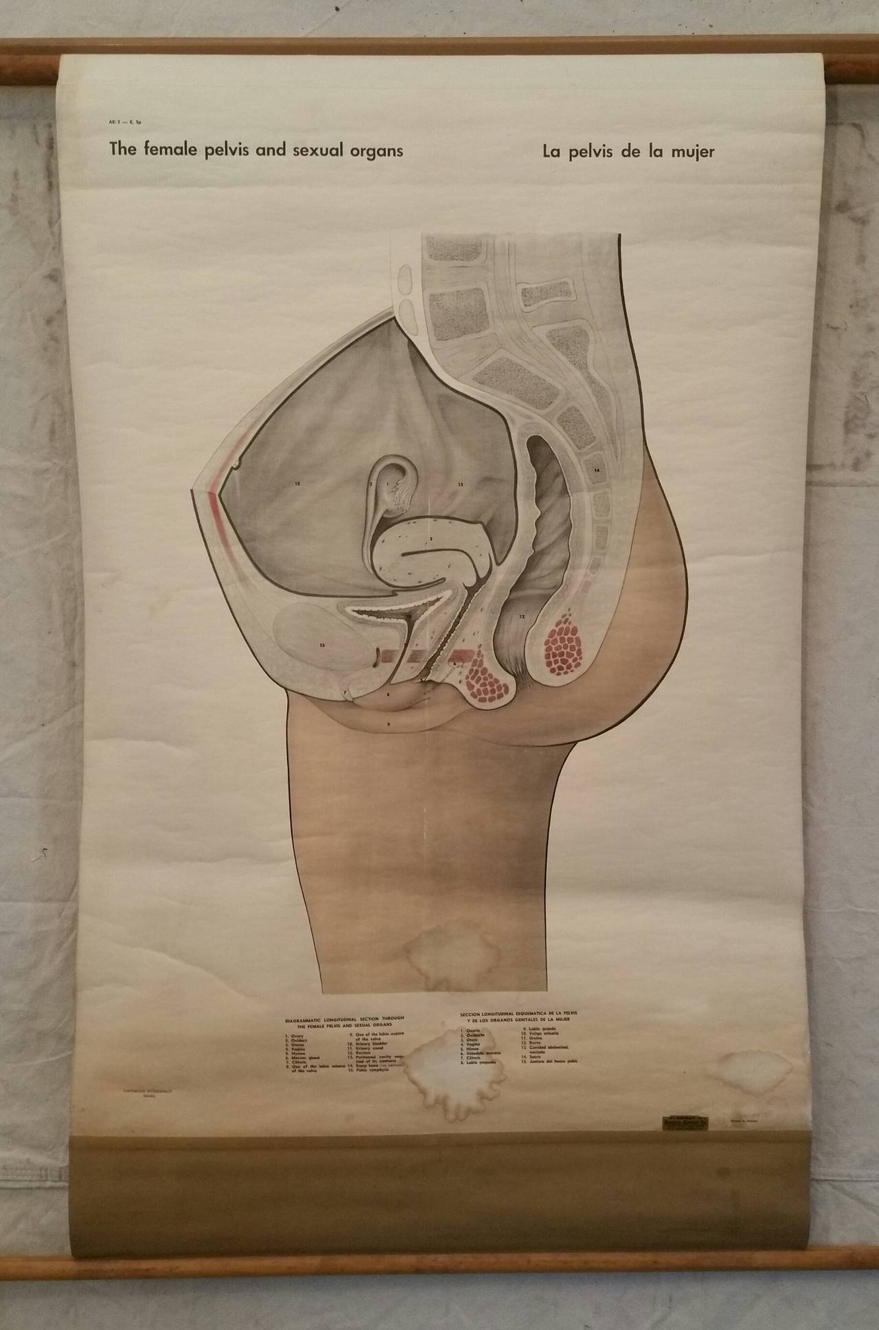 Rare Medical Chart , "Female Pelvis and Sexual Organs, " Made in Sweden