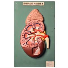Vintage Medical Wall Plaque of the Human Kidney