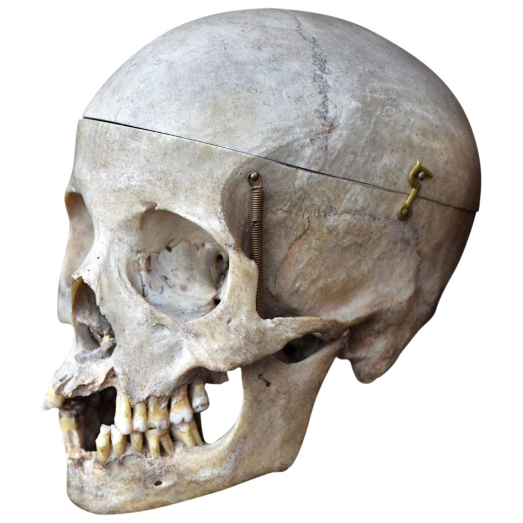 Human Skull Example 0.1