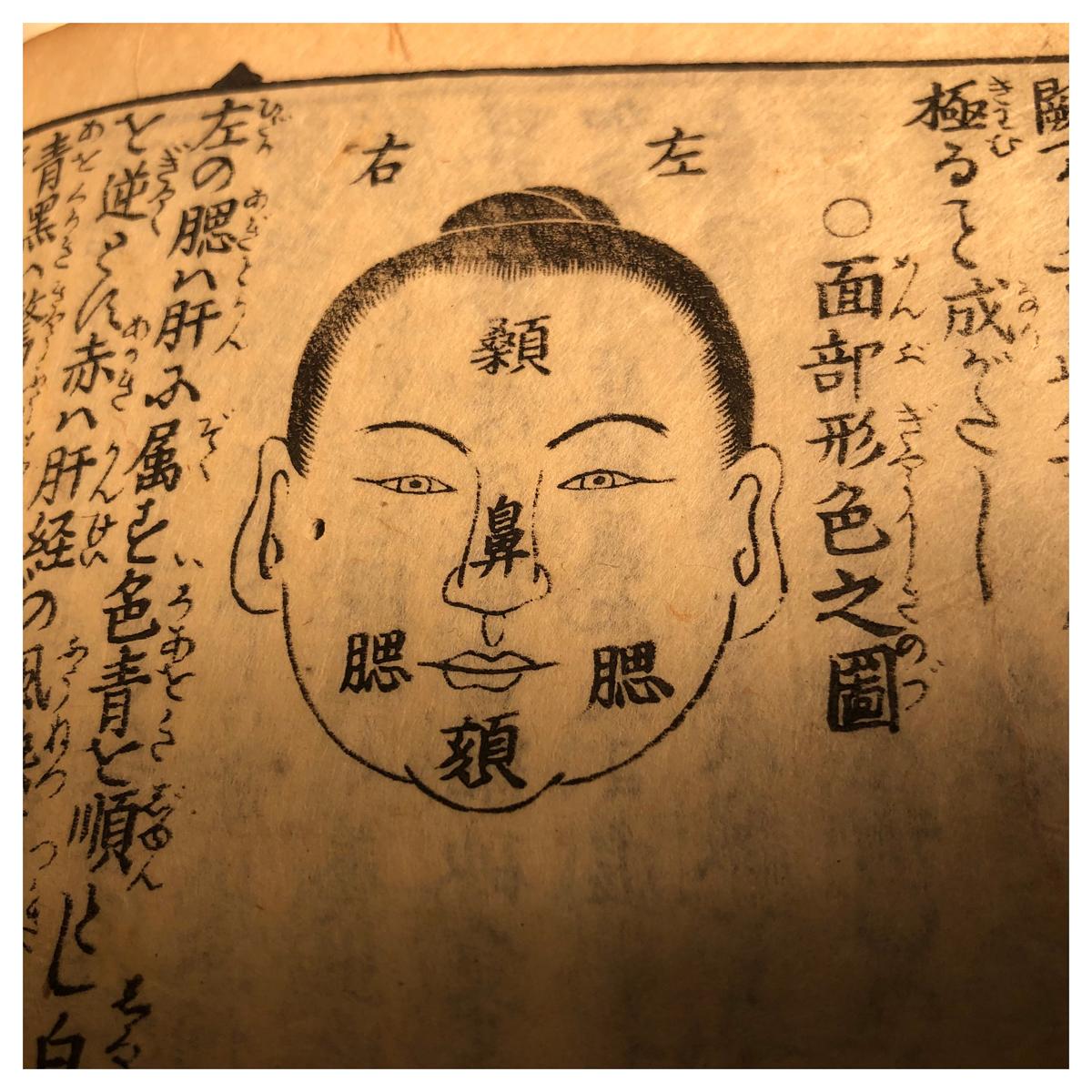 Important Chinese Acupuncture Antique Woodblock Hand Book, 19th Century Prints