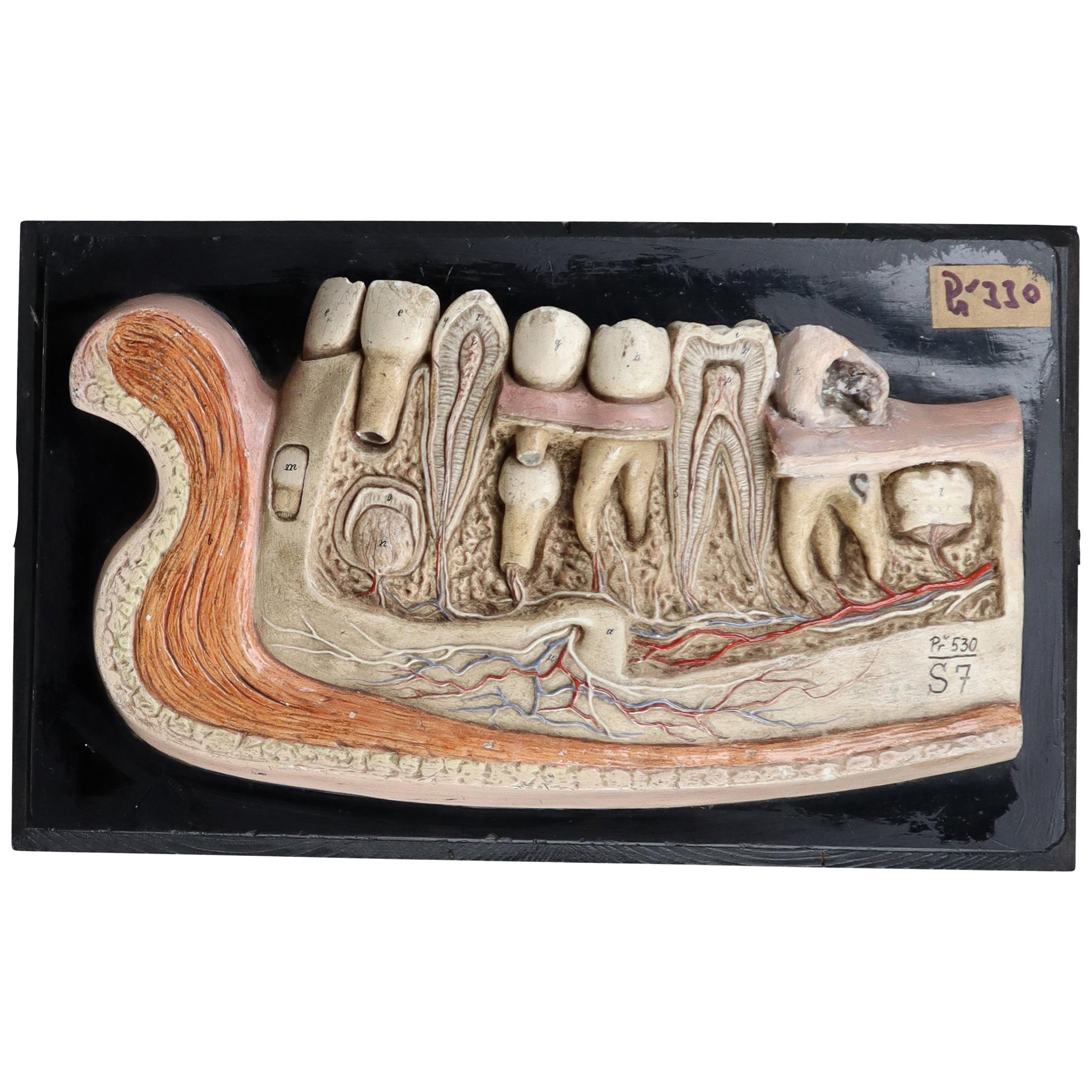 Lower Jaw Anatomical model Wood and Plaster on metal base Czech Republic, 1930s