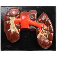 Kidneys Anatomical Model Wood and Plaster on Metal Base CZ, 1940s