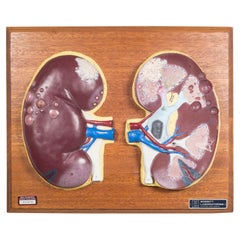 Vintage Professional Medical Teaching Display of Human Kidneys c.1950