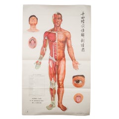 Retro Chinese Acupuncture Posters c.1976